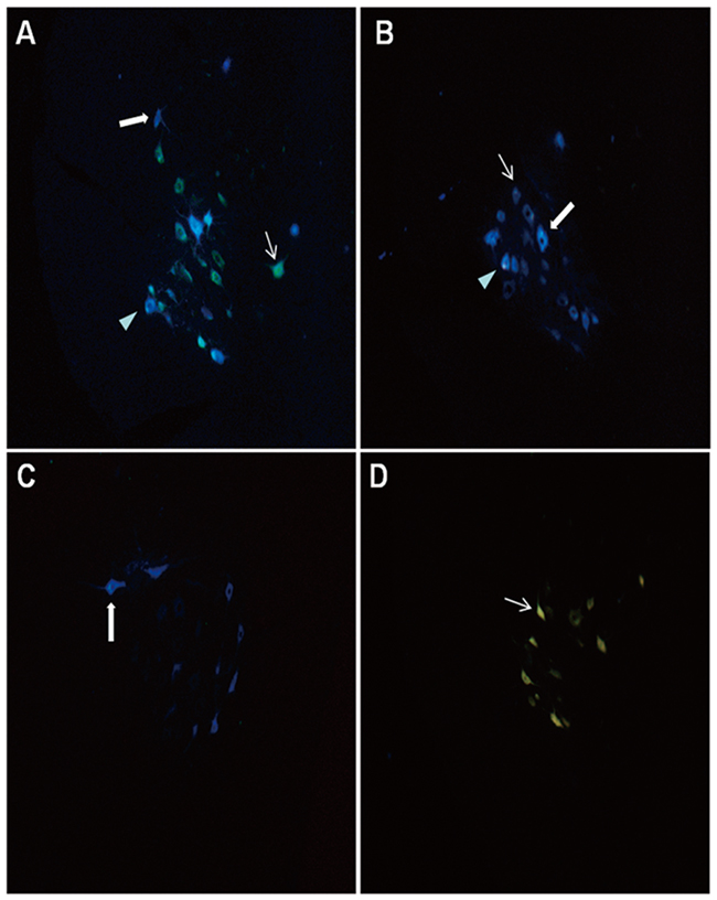 Distribution of retrogradely labeled neurons observed under ultraviolet fluorescence microscope: &#x2192; FG labeled neurons; &#x27A8; FB labeled neurons; &#x25B6; FG-FB double labeled neurons.