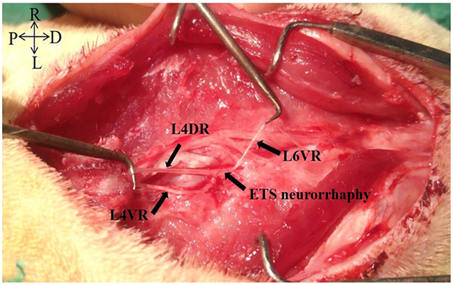 The macroscopic photo of L4VR-ETS Neurorrhaphy at 4 months after surgery.
