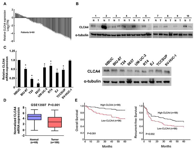 Figure 1: CLCA4 expression is decreased in bladder cancer.