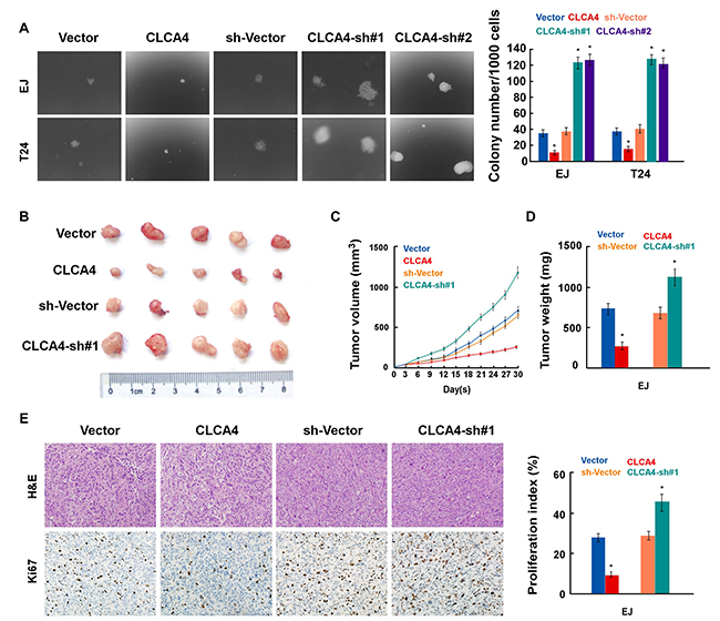 CLCA4 overexpression enhances the tumorigenicity of bladder cancer cells.