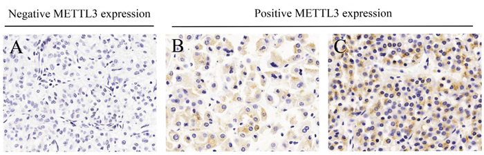 Different immunohistochemistry results of METTL3 expression in microarray.