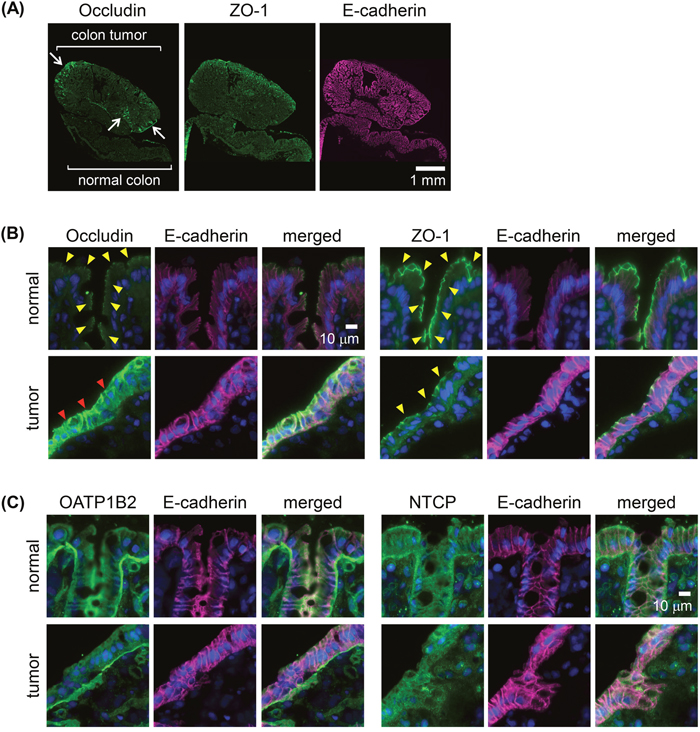 Immunoreactivities of membrane transporters and tight junction (TJ) molecules in AOM-induced colon carcinogenesis in rats.