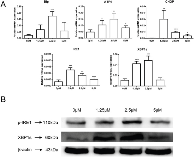 Celastrol induced ER stress in HCC cells.