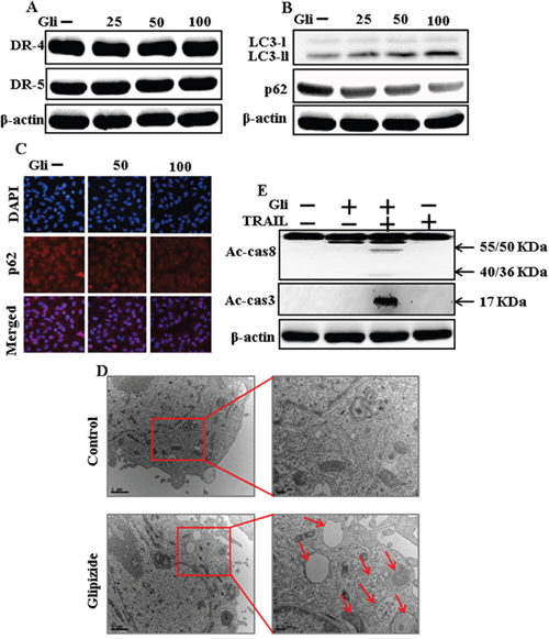 Glipizide induces autophagy and sensitized apoptosis mediated by TRAIL. A549 cells were pre-incubated with glipizide at varying doses (0, 25, 50, and 100 &#x03BC;M) for 12 h.