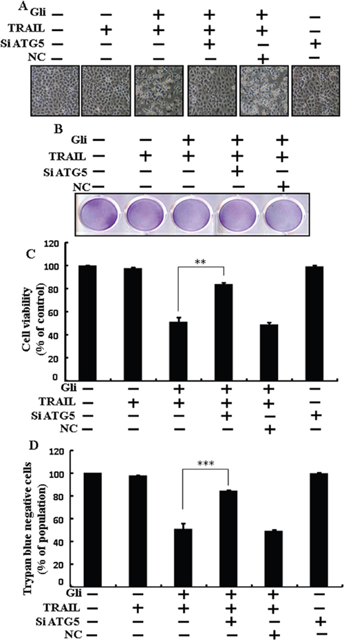 Glipizide enhanced TRAIL-induced apoptosis is blocked by genetic inhibition of autophagy.
