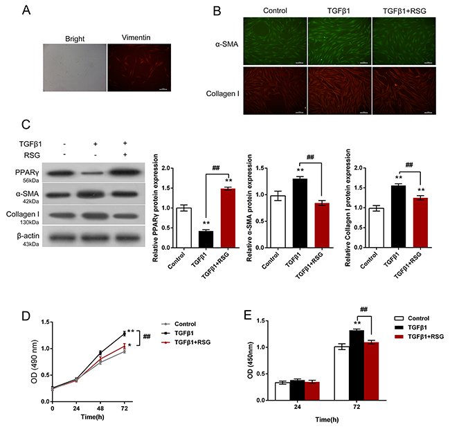 Effects of RSG on TGF-&#x03B2;1-induced HTFs activation and proliferation.