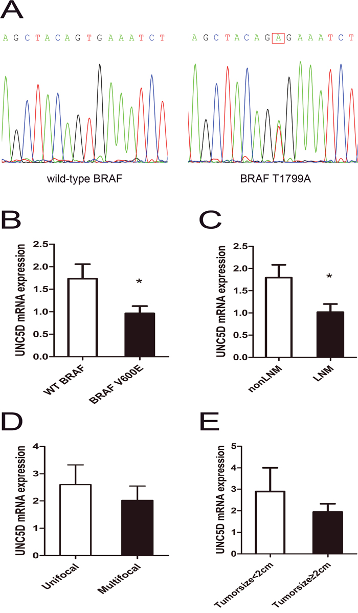 Aggressive tumor behaviors affected UNC5D mRNA expression levels in PTC.