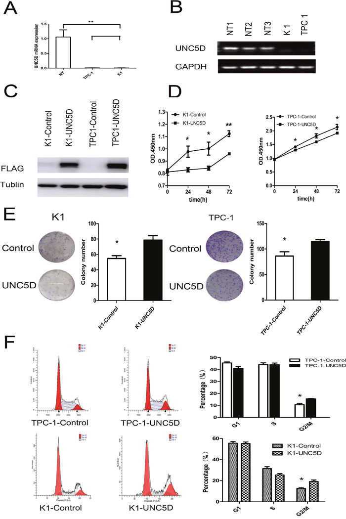 UNC5D inhibits PTC cell growth and cell cycle status.