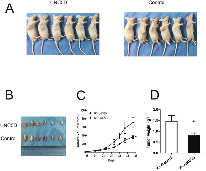 UNC5D inhibits PTC growth in vivo.