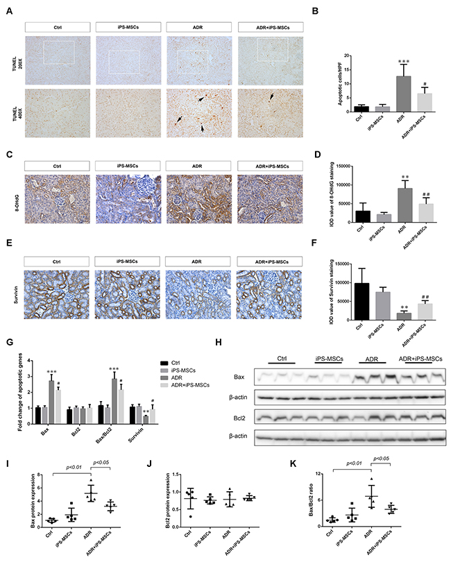 iPS-MSCs reduced tubular apoptosis and oxidative damage in murine adriamycin nephropathy (AN).