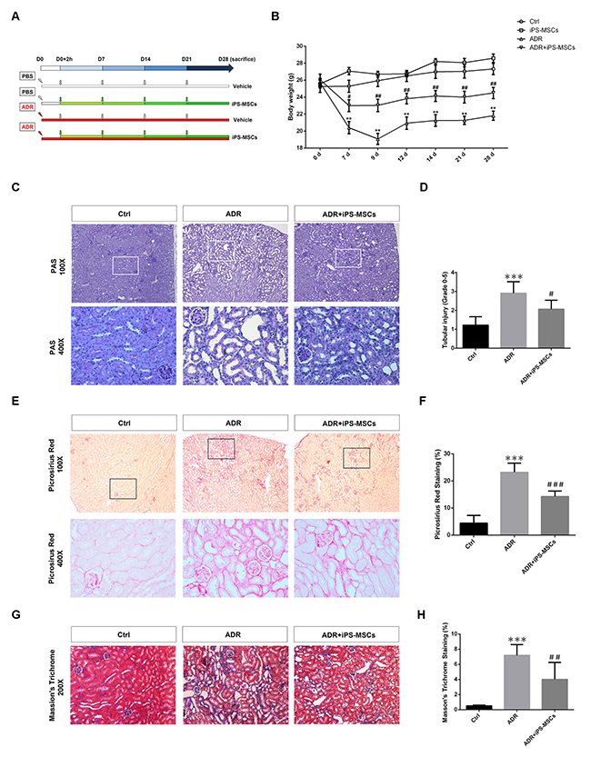 iPS-MSC treatment maintained tubulointerstitial architecture in renal cortex during AN injury.