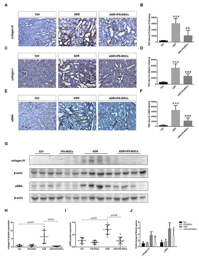 iPS-MSCs attenuated interstitial fibrosis in AN mice.