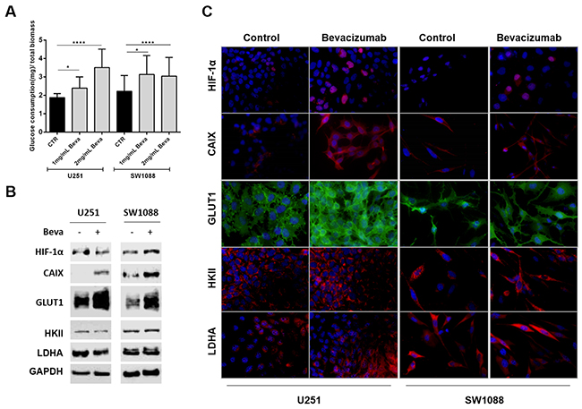 Effect of Bevacizumab treatment on glucose metabolism of GBM cells.