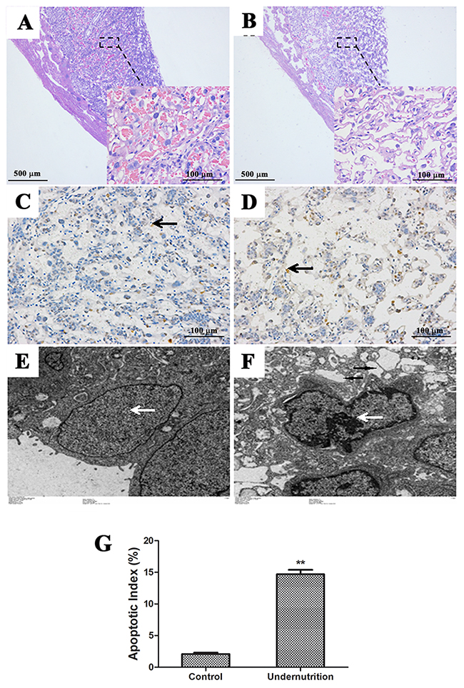 Histological changes and cell apoptosis in rat placentae under prenatal maternal undernutrition.