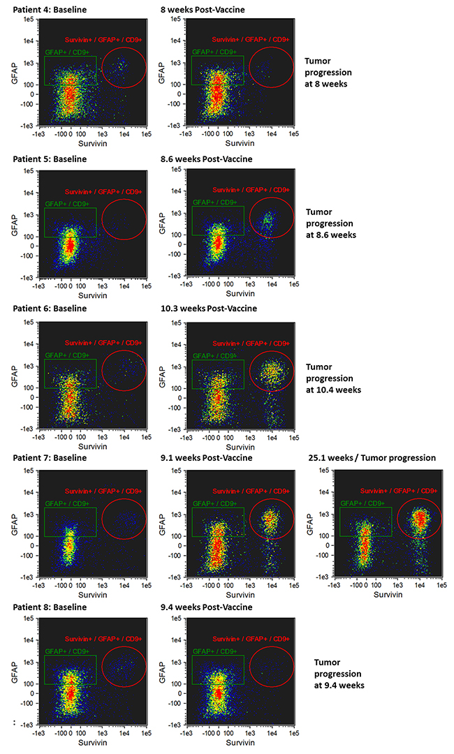 Imaging flow cytometry of CD9&#x002B;/GFAP&#x002B;/SVN&#x002B; exosomes in patients whose tumors progressed early (8.0-25.1 weeks) following initial vaccination.