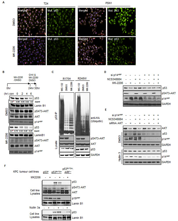 Fig.5: Inhibition of AKT decreases p53mut stability.