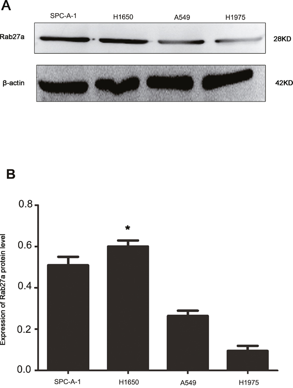 Expression of Rab27a protein in four non-small cell lung cancer cell lines.