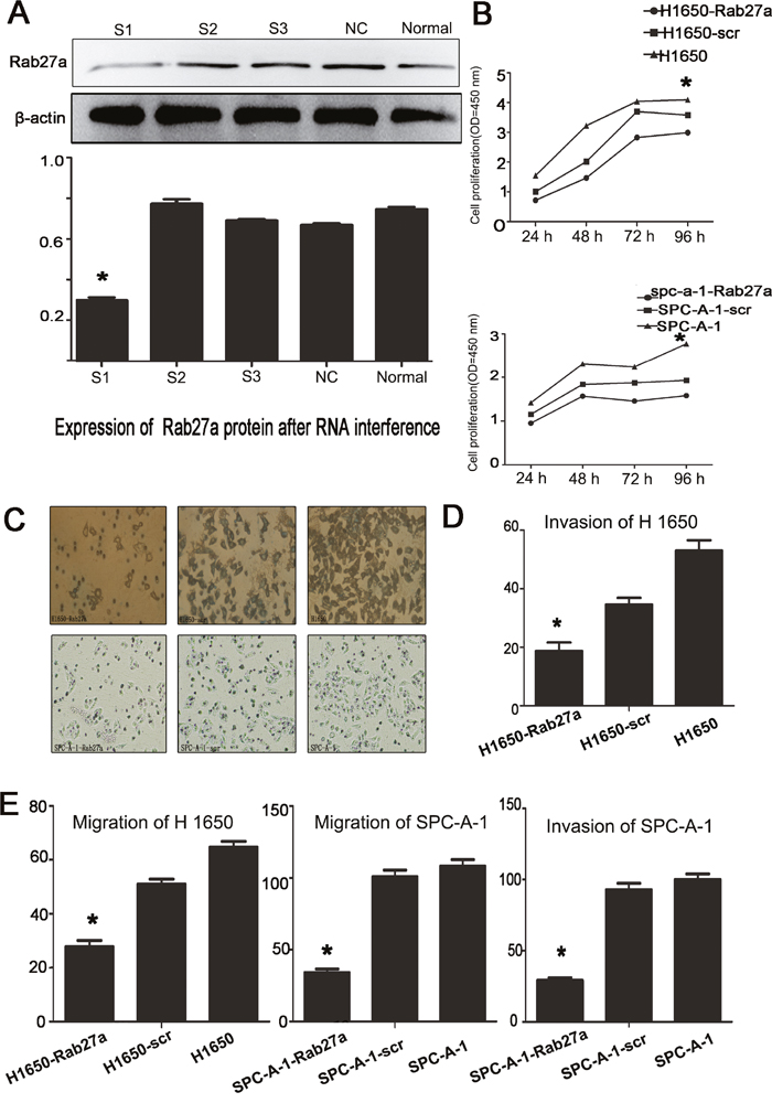 Effect of depleting or enforcing the expression of Rab27a on cell proliferation, migration and invasiveness of lung carcinoma cells.