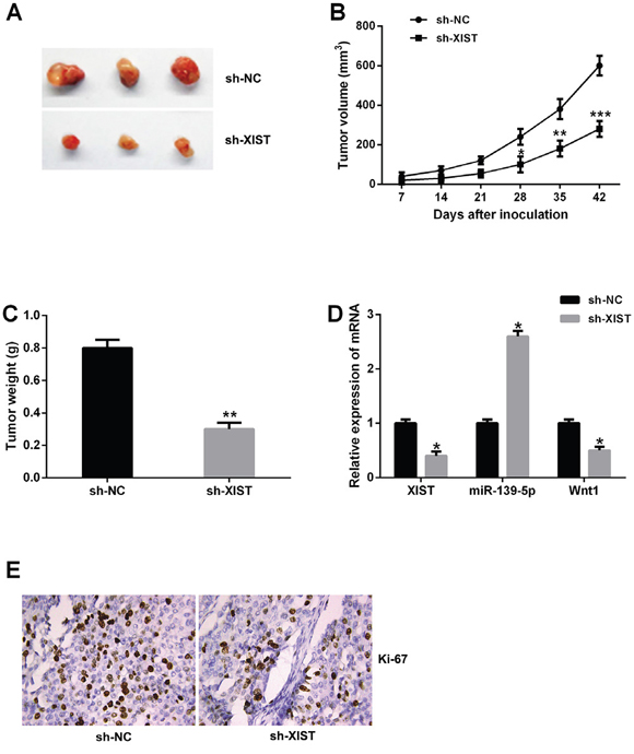 XIST inhibition suppressed tumor growth of bladder cancer in vivo.