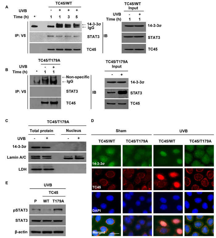 14-3-3&#x3c3; transports TC45 into the keratinocyte nucleus following UVB irradiation through direct binding.