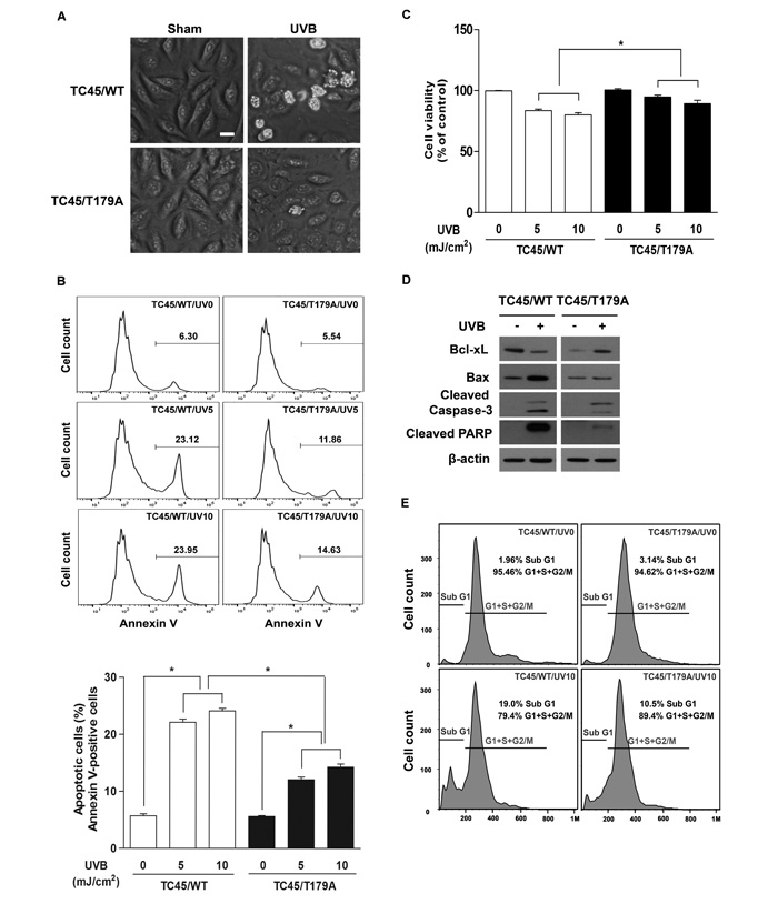 Inhibition of TC45 nuclear translocation suppresses UVB-induced apoptosis in keratinocytes.