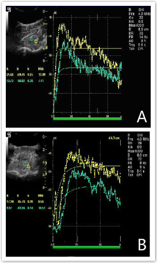 The rCBF values at sites 1 and 2 cm away from the compression site both decreased to varying extents.