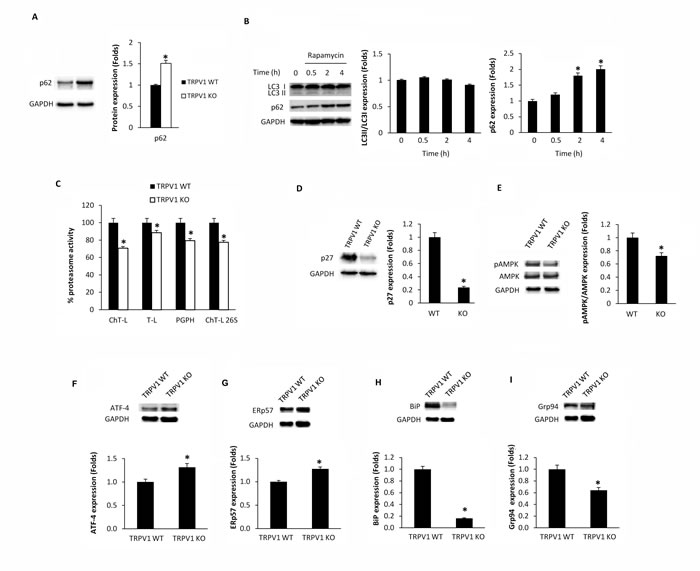 Knock-out of TRPV1 gene affects autophagy, proteasome and UPR protein expression in thymocytes.