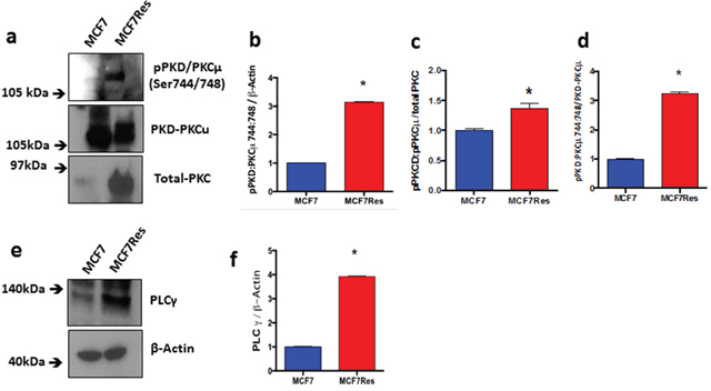 Expression and differential phosphorylation of PKD/PKC&#x03BC; and PLC&#x03B3;.