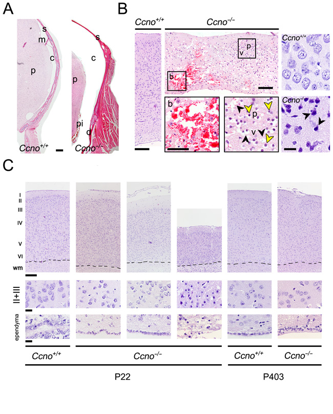 Neuronal damage in the CNS of