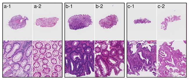 Examples of tissue images from Tokyo hospital and East hospital.