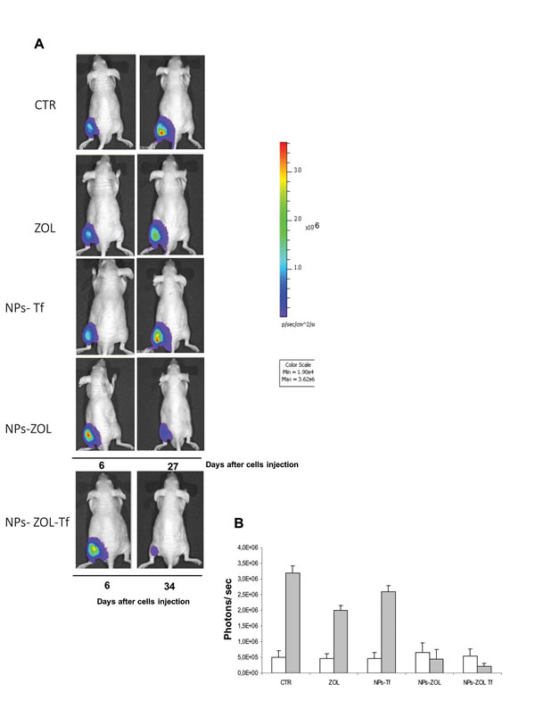 Antitumor effect of NPs-ZOL-Tf on luminescent xenograft.