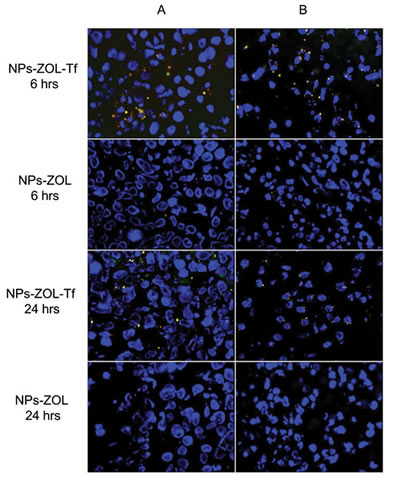 Distribution of NPs in mice brain by fluorescent microscopy.