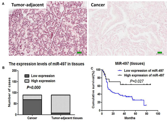 Figure 7 Expression levels and prognostic values of miR-497 in pancreatic cancer tissues.