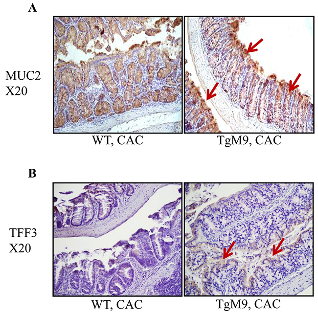 MMP9 maintains mucin levels in CAC.