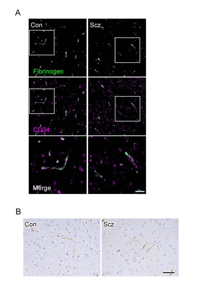No leakage of fibrinogen and IgG are observed from microvessels in the schizophrenic PFC.