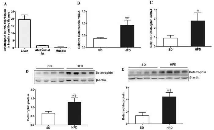 Expression of betatrophin at mRNA and protein levels in mice.
