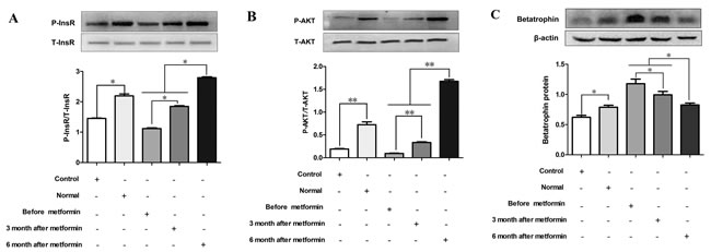 Effects of serum from normal and IR women on insulin signaling and betatrophin.