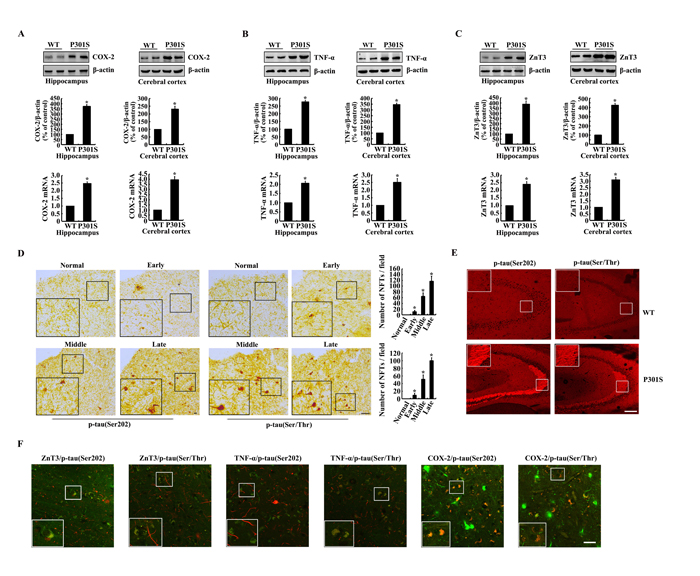 The expression of COX-2, TNF-&#x3b1;, ZnT3 and phosphorylation of tau at the sites of both Ser 202 and Ser 400/Thr 403/Ser 404 were upregulated in 6-month-old Tau