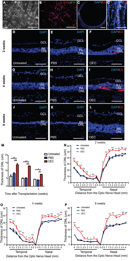 Characterization of OECs and protection of the ONL of light-damaged retinas of LE rats.