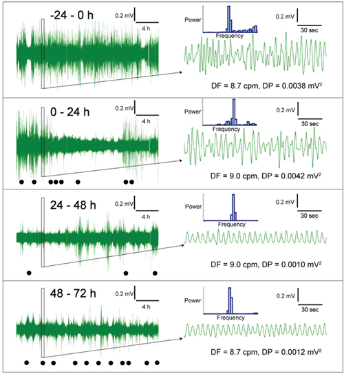 Representative traces of gastric myoelectric activity recordings in a ferret that had received cisplatin (5 mg/kg, i.p.).