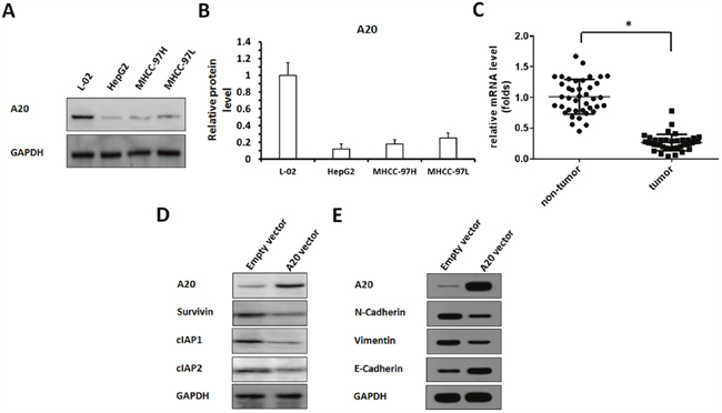 The expression of A20, and other proteins in HCC cells or clinical specimens.