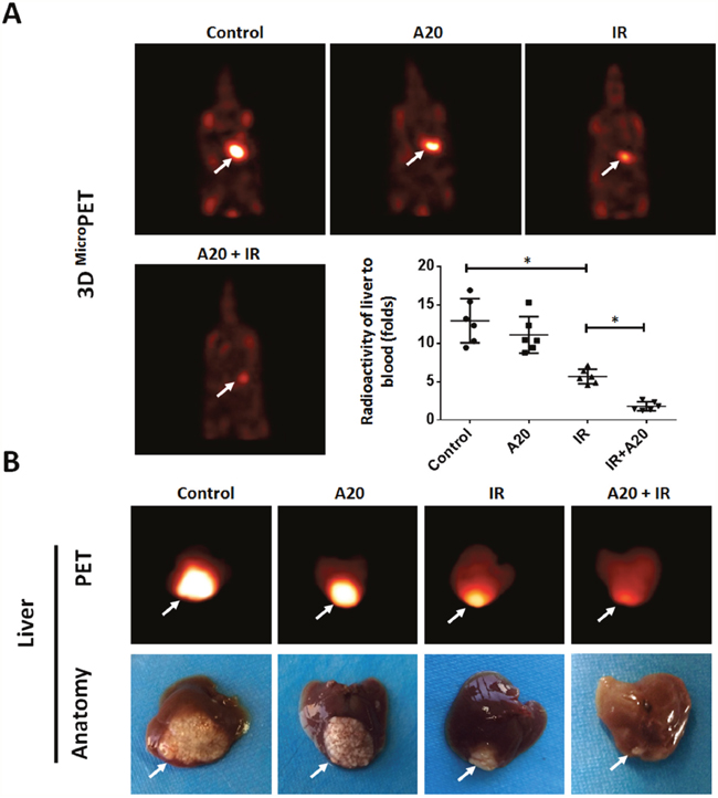 Overexpression of A20 enhances the sensitivity of HepG2 cells to IR via a nude mice intra-hepatic tumor model.