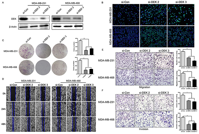 DEK knock-down attenuated the ability of proliferation, migration and invasion of TNBC cells in vitro.