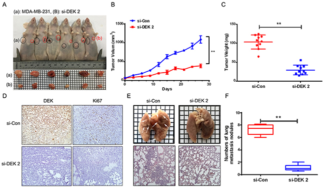 Silence of DEK inhibited tumor growth and metastasis in mouse xenograft model.