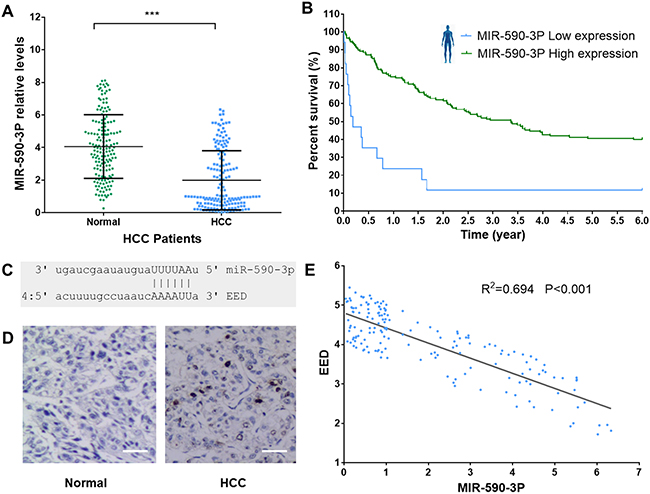 MiR-590-3P level is associated with HCC survival.