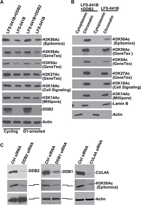 Depletion of CRL4DDB2 components DDB2, DDB1 and CUL4A decrease H3K56Ac levels.