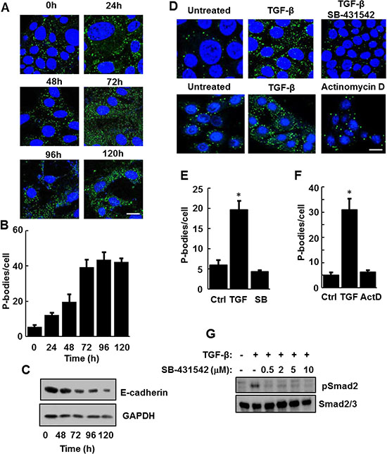 TGF-&#x03B2; receptor signaling is required for the induction of P-bodies.