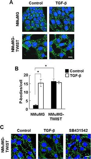 NMuMG cells expressing TWIST have high levels of P-bodies.