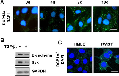 TGF-&#x03B2; promotes P-body accumulation HMLE and DG75 cells.