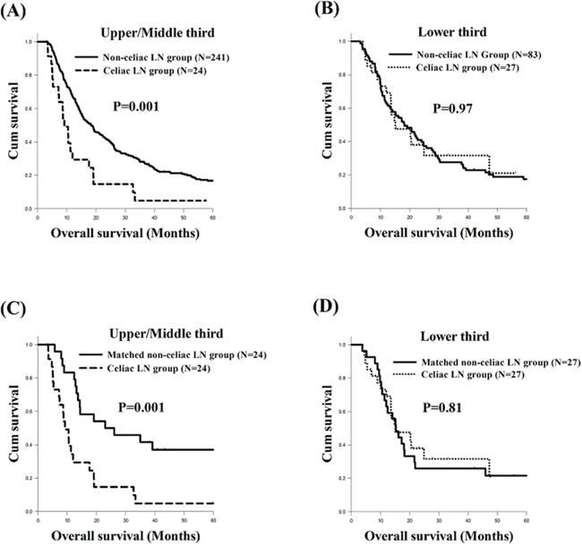 Comparison of overall survival curves of esophageal squamous cell carcinoma patients with different tumor locations.